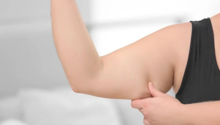 Cách Giảm Mỡ Bắp Tay Nhanh Chóng: Bài Tập Đơn Giản Hiệu Quả