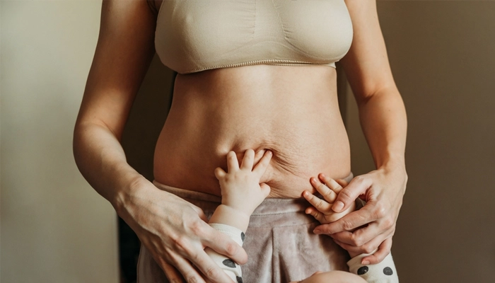 Giảm Béo Sau Sinh: Cải Thiện Vóc Dáng Sau Khi Sinh Con