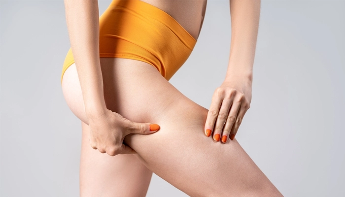 Cách Giảm Mỡ Đùi Tại Nhà: Bí Quyết Để Có Đôi Chân Thon Gọn